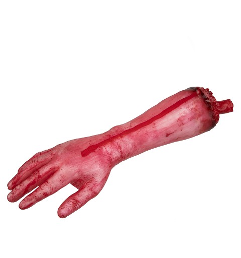  Antebrazo Amputado